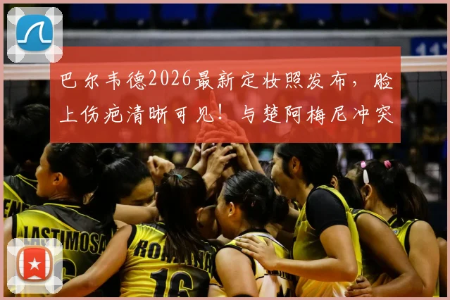 巴尔韦德2026最新定妆照发布，脸上伤疤清晰可见！与楚阿梅尼冲突细节全回顾